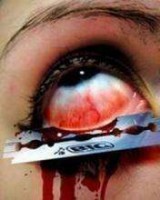Eye procedure