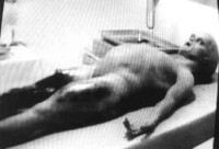 roswell autopsy
